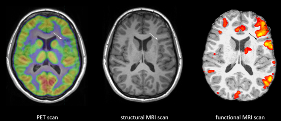 Functional MRI